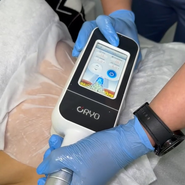 5 криолиполиз копия.jpg 5 криолиполиз копия.jpg